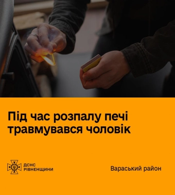 У Вараському районі чоловік отримав серйозні опіки під час розпалювання грубки