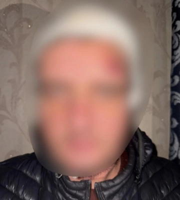 У Київській області чоловік зберігав вибухонебезпечні предмети: правоохоронці повідомили фігуранту про підозру