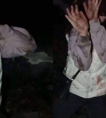 На Днепропетровщине группа подростков жестоко избила девушку: что говорят в полиции