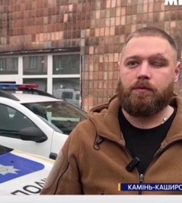 Втратив око на фронті та знайшов себе в поліції: історія ветерана Нацгвардії з Волині (відео)