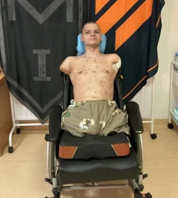 "Приватбанк" попал в скандал: в Киеве военный с ампутацией не смог получить карту