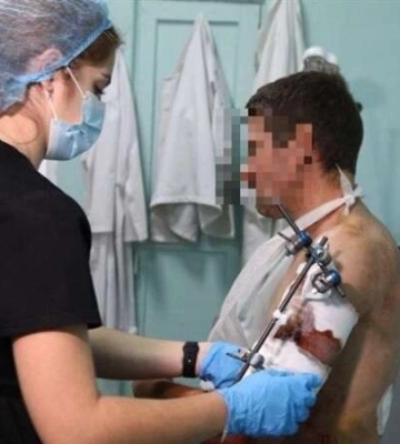 В больницу его доставили без сознания. В Днепре продолжают спасать раненых (Фото)