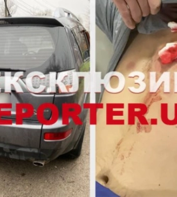 У Дніпрі невідомий обстріляв та поранив 34-річного чоловіка