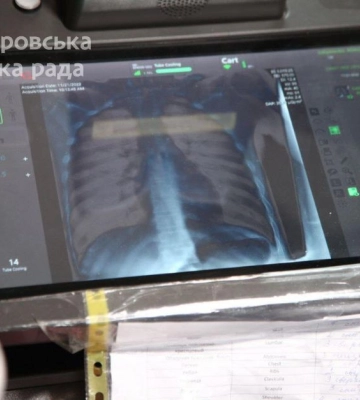 У Дніпрі рятують військовослужбовців і цивільних, які отримали поранення під час бойових дій