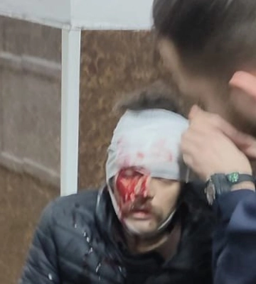 Ворог поцілив у пожежно-рятувальну частину в Бахмуті, - ДСНС. ФОТО