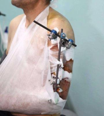 У Дніпрі під час пожежі загинув чоловік