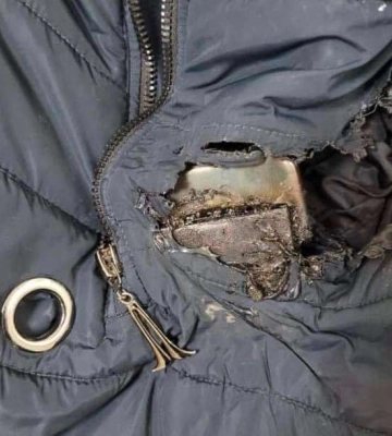Внаслідок ракетного удару осколкове поранення отримала співробітниця мерії Дніпра