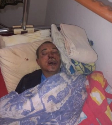 “Кинули в багажник і вивезли”: на Закарпатті до полусмерті збили на автомобілі  чоловіка