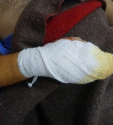 Тело прошили обломки снаряда: в Днепре спасли тяжелораненого бойца
