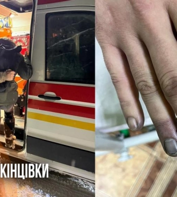 Заблукали в лісі та отримали обмороження: виявили двох чоловіків, які намагалися перетнути кордон на Рівненщині