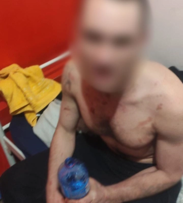 Підірвав гранату у хостелі під час повітряної атаки на Київ - затриманому повідомлено про підозру