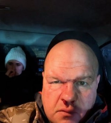 Група молодиків на квадроциклах побила військового у Кременці на Тернопільщині: підполковник ТЦК намагався залякати воїна. ВIДЕО
