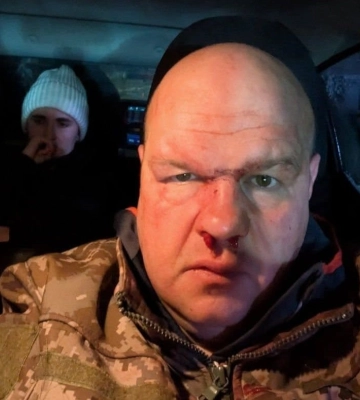 У Кременці підприємці побили офіцера ЗСУ: поліція розслідує справу