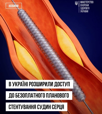 Планове стентування судин безоплатне для мешканців Закарпаття