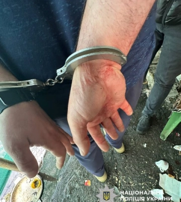 Запросила у гості й отримала ножа у спину: у Черкасах затримали підозрюваного