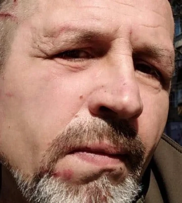 Нардеп сообщил, что в помещении столичного ТЦК избили ветерана Балуха. Полиция проверяет информацию