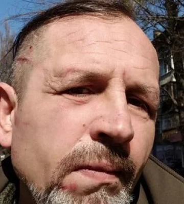 Колишнього політв’язня Кремля Балуха побили у приміщенні ТЦК Києва: поліція перевіряє інформацію