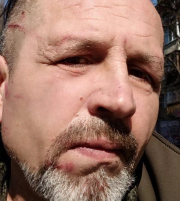Киевская полиция проверяет информацию о избиении ветерана Балуха в помещении ТЦК