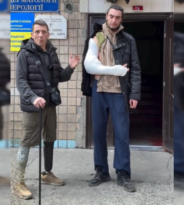 В Одессе военному сломали руку при попытке силовой мобилизации: ветераны требуют контроля за ТЦК