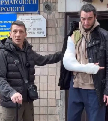 В Одесі працівники ТЦК намагалися бусифікувати ветерана ЗСУ і зламали йому руку