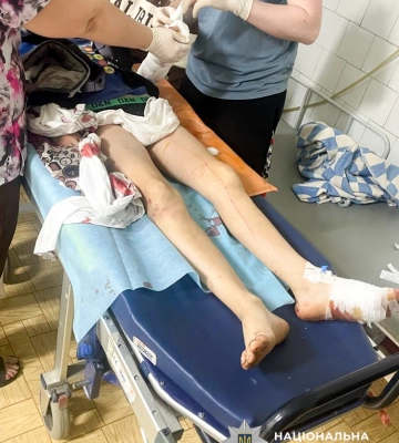 На Рівненщині охоронні собаки покусали двох дітей та свого власника, - поліція