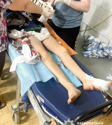 На Рівненщині охоронні собаки покусали двох дітей та свого власника, - поліція