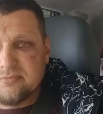 У Луцьку ветеран звернувся до поліції через побиття працівниками ТЦК: що відомо