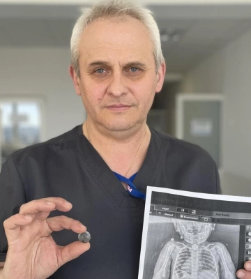 Хірурги Львова дістали зі стравоходу 2-річної дівчинки батарейку, з якою вона жила три місяці