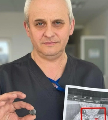 Во Львове спасли ребенка, который месяцами жил с батарейкой в пищеводе