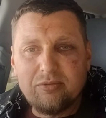 "За що я воював?": ветерана з інвалідністю побили військові ТЦК