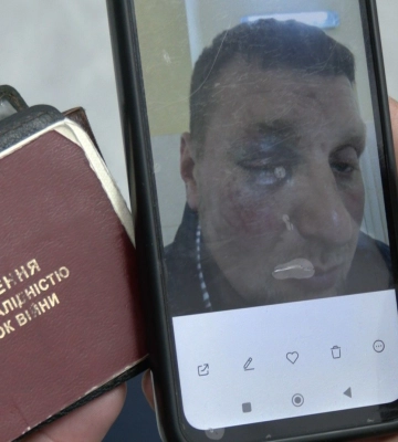 Поліція розлідує побиття ветерана у Луцьку. Що відомо