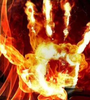 У Горішніх Плавнях жінку облили легкозаймистою речовиною та підпалили