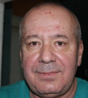 Василь Русин в Ужгороді: пам’яті легендарного хірурга, який змінив медицину Закарпаття