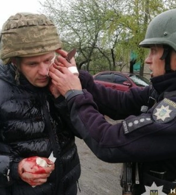 Пятеро полицейских ранены в результате взрыва гранаты во время задержания мужчины в Днепропетровской области. ФОТОРЕПОРТАЖ