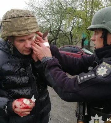 У Дніпропетровській області чоловік кинув дві гранати в поліцейських: п'ятеро поранених