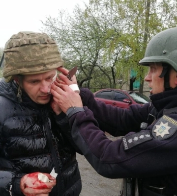 На Днепропетровщине мужчина во время задержания бросил гранату в полицейских, есть раненые