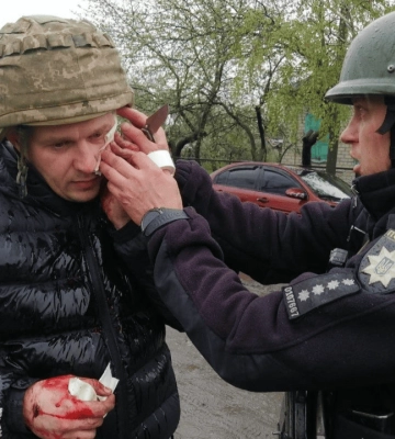 Кинув гранату у поліцейських, є поранені: на Дніпропетровщині затримали агресора