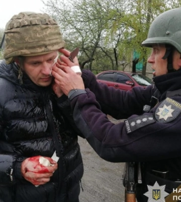На Дніпропетровщині чоловік кинув дві гранати в поліцейських: є поранені