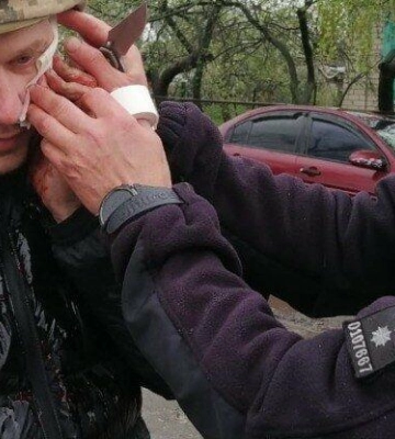 Вибух під час спецоперації: на Дніпропетровщині п’ятеро поліцейських постраждали