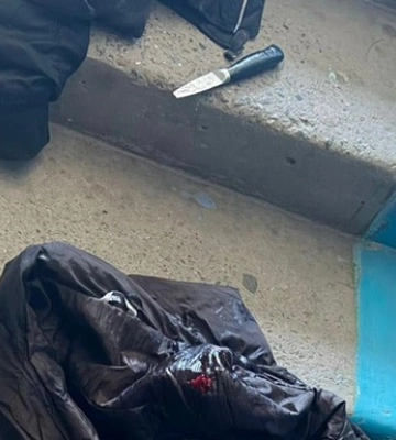 В Тернополе ссора двух школьниц дошла до поножовщины: есть раненая