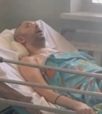 Лубінець повідомив про госпіталізацію мешканця Дніпра з важкою травмою голови через дії ймовірних представників ТЦК