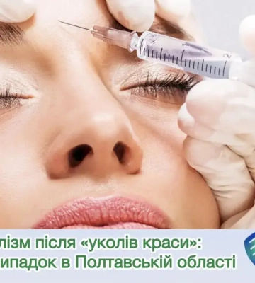 На Полтавщині жінка захворіла на ботулізм після уколів краси