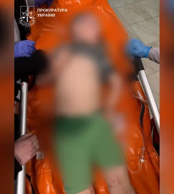 Під Києвом чоловік напідпитку побив 7-річного сина, дитину госпіталізували