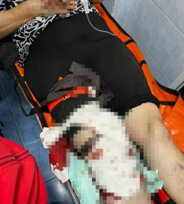 На Рахівщині корова ледь не вбила жінку: медики витягли постраждалу з того світу (ФОТО)