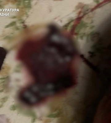 Сусідка вдарила ножем у спину чоловіка в одному із гуртожитків Черкас