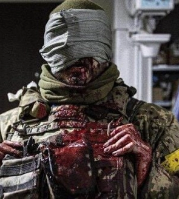 Обличчя пораненого під Бахмутом українського воїна. ФОТО ДНЯ