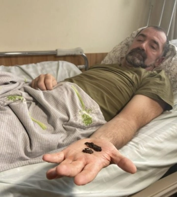 Ледь не загинув на свій день народження: у Львові захисник після важкого поранення знову вчиться ходити