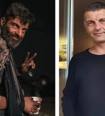 Защитник Мариуполя, фотографии которого облетели весь мир, успешно перенес операцию в США (ФОТО)