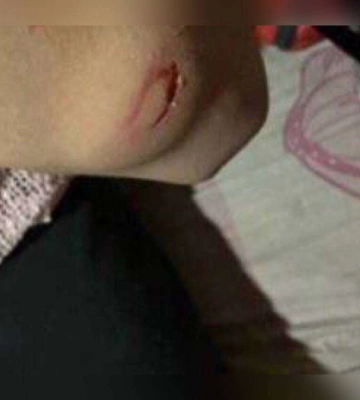 У Дніпрі чоловік побив 14-річну доньку співмешканки палицею
