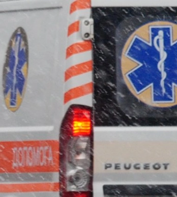 У Полтавському районі госпіталізували однорічну дитину із опіками обличчя